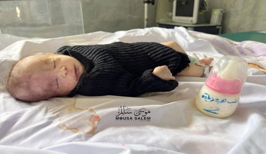الأورومتوسطي: معدل الوفيات جراء الجوع يرتفع بشكل مخيف في غزة

